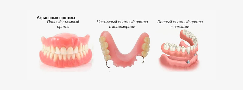 Акрил протезы 