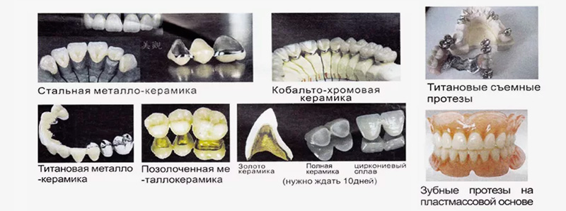 протезирование зубов 